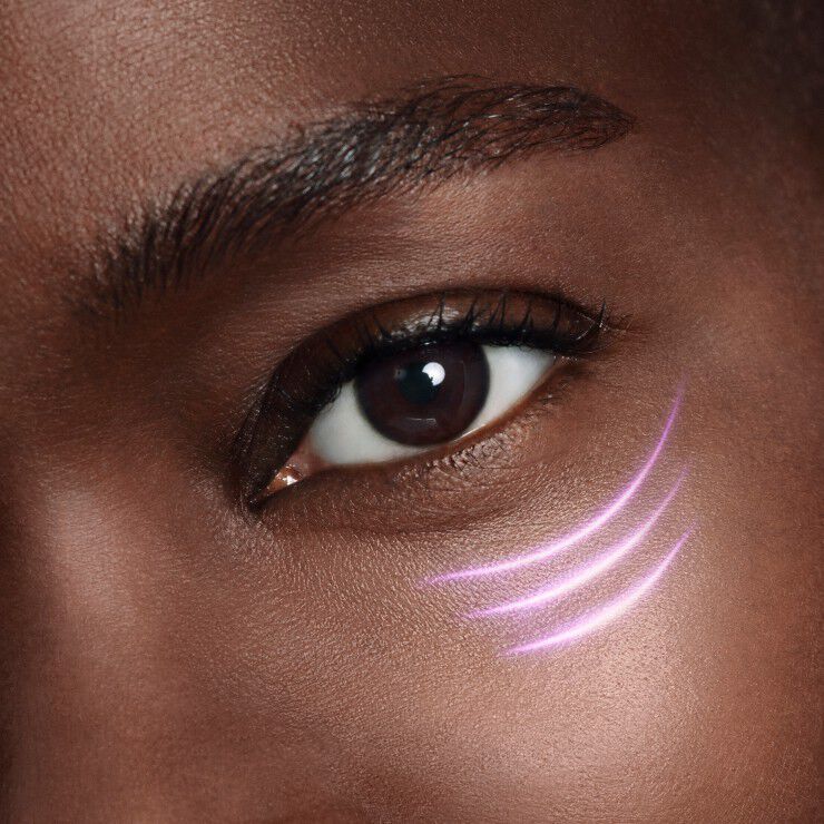 Zatvoren kadar na ljudskom oku s ljubičastim crtama na obrazu, ističući detail i teksturu kože.